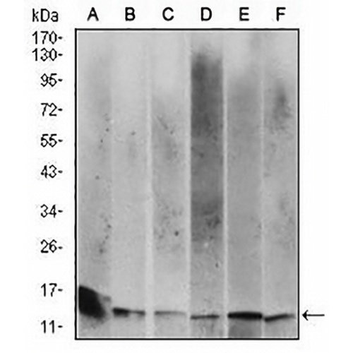 Beta 2 Microglobulin Mouse Monoclonal Antibody(C2543)
