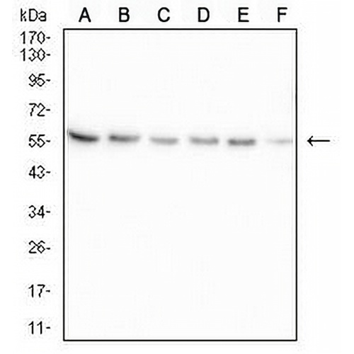B4GALNT1 Mouse Monoclonal Antibody(C2547)