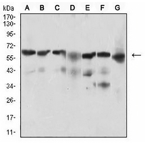 BACE1 Mouse Monoclonal Antibody(C2548)