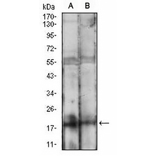 BAD Mouse Monoclonal Antibody(C2549)