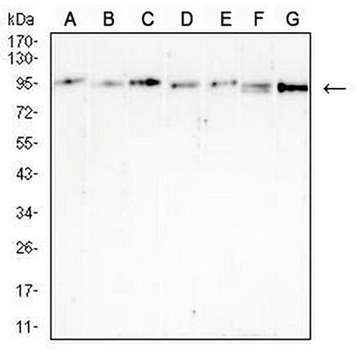 B-RAF Mouse Monoclonal Antibody(C2559)