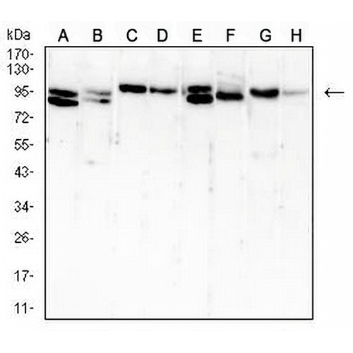 B-RAF Mouse Monoclonal Antibody(C2560)