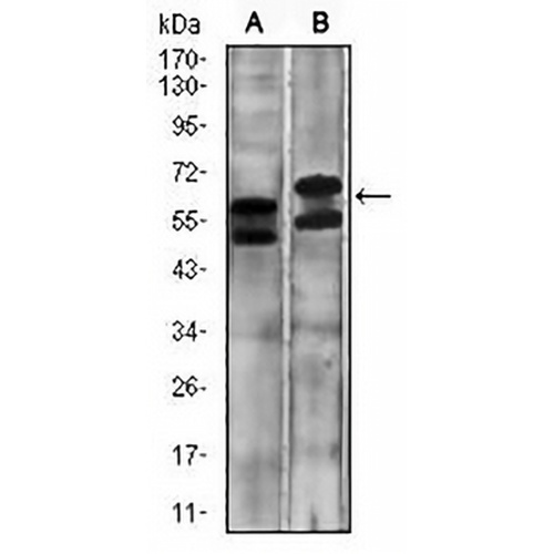 Carbonic Anhydrase 9 Mouse Monoclonal Antibody(C2569)