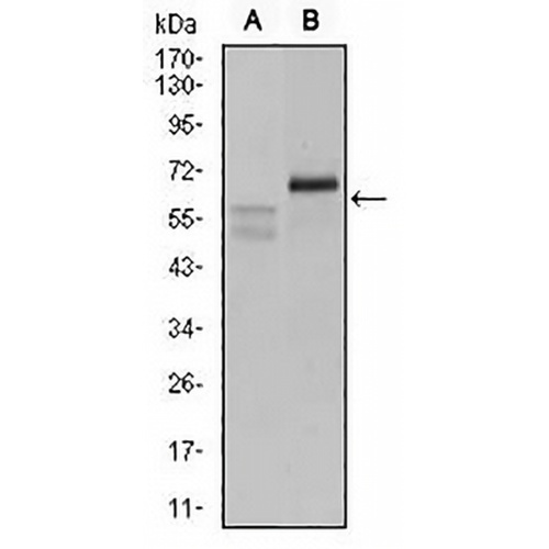 Carbonic Anhydrase 9 Mouse Monoclonal Antibody(C2570)