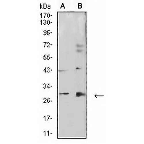Calretinin Mouse Monoclonal Antibody(C2571)