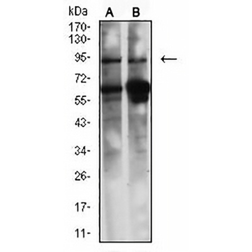 Caldesmon Mouse Monoclonal Antibody(C2572)