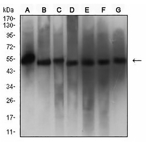 Calreticulin Mouse Monoclonal Antibody(C2573)