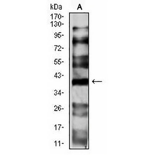 CD191 Mouse Monoclonal Antibody(C2586)