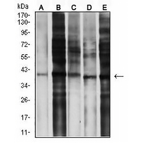 CCR5 Mouse Monoclonal Antibody(C2587)