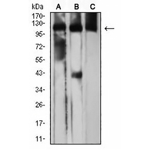 CD163 Mouse Monoclonal Antibody(C2591)