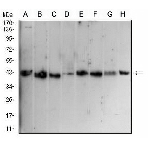 CD1a Mouse Monoclonal Antibody(C2593)