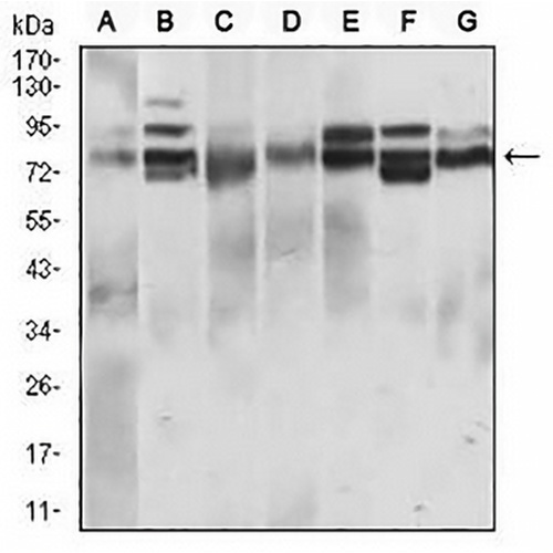 CD22 Mouse Monoclonal Antibody(C2597)