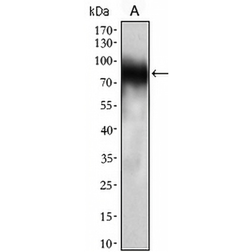 CD33 Mouse Monoclonal Antibody(C2598)