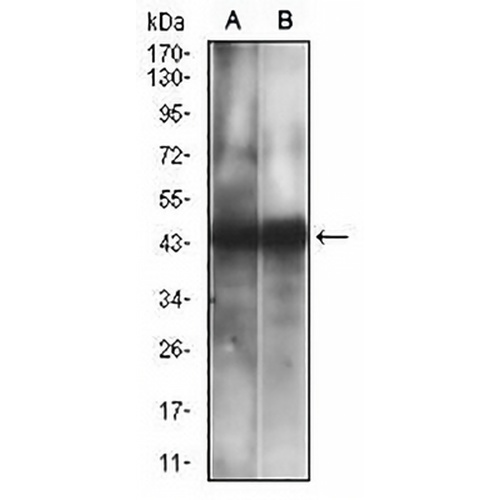 CD38 Mouse Monoclonal Antibody(C2600)