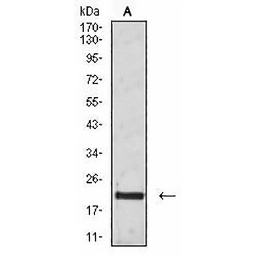 CD3g Mouse Monoclonal Antibody(C2602)