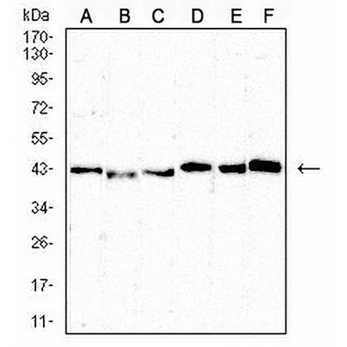 CD5 Mouse Monoclonal Antibody(C2607)