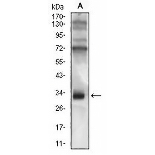 CD74 Mouse Monoclonal Antibody(C2611)