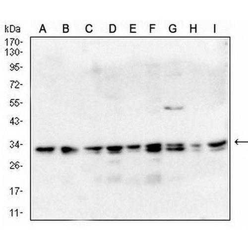 CD81 Mouse Monoclonal Antibody(C2612)