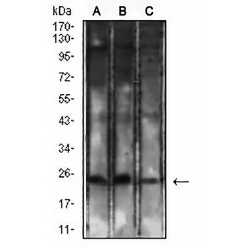 CD8a Mouse Monoclonal Antibody(C2613)