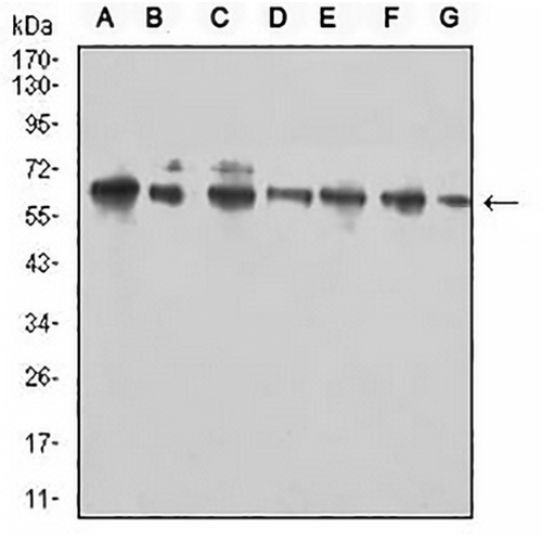 CD96 Mouse Monoclonal Antibody(C2614)