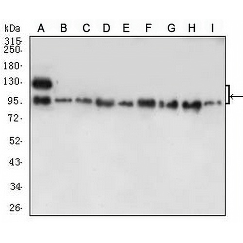 E Cadherin Mouse Monoclonal Antibody(C2618)