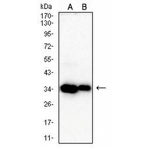 CDK4 Mouse Monoclonal Antibody(C2623)