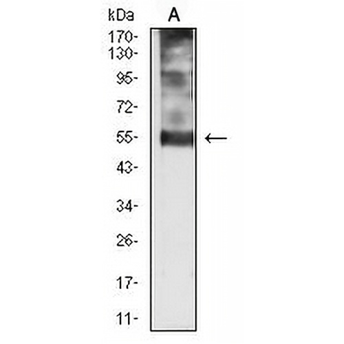 p57 Kip2 Mouse Monoclonal Antibody(C2624)