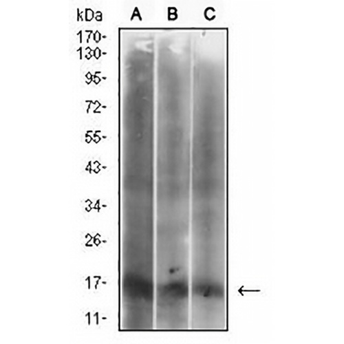 p16 INK4a Mouse Monoclonal Antibody(C2625)