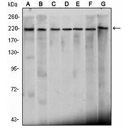 CHD3 Mouse Monoclonal Antibody(C2633)