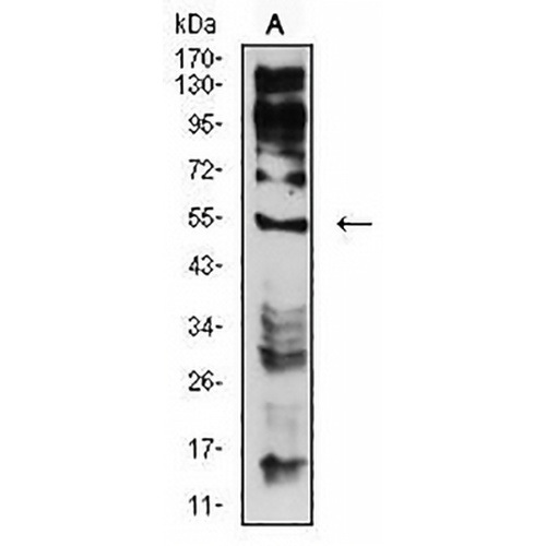 CHRNE Mouse Monoclonal Antibody(C2640)