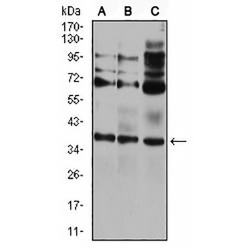 CIDEC Mouse Monoclonal Antibody(C2641)