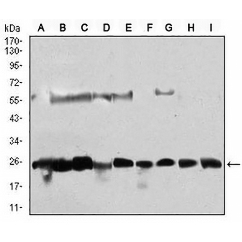 CK2 beta Mouse Monoclonal Antibody(C2651)