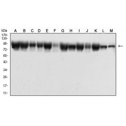 Beta-catenin Mouse Monoclonal Antibody(C2652)