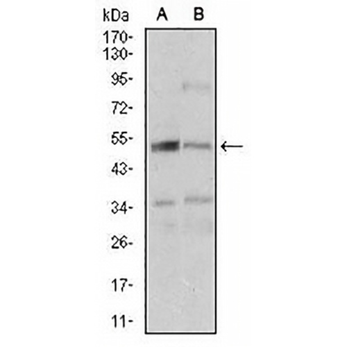 DAP Kinase 3 Mouse Monoclonal Antibody(C2657)