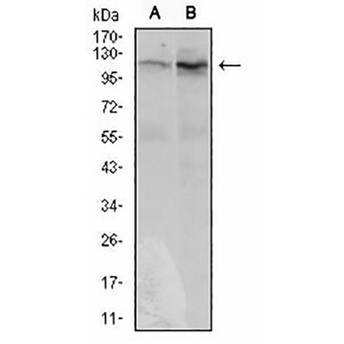 DIS3L2 Mouse Monoclonal Antibody(C2666)