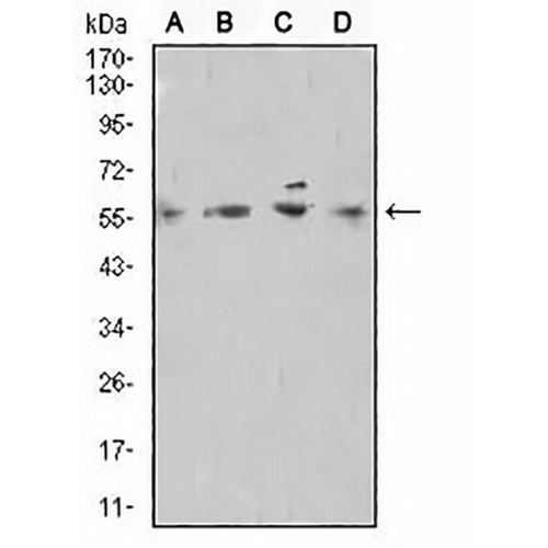 TdT Mouse Monoclonal Antibody(C2673)