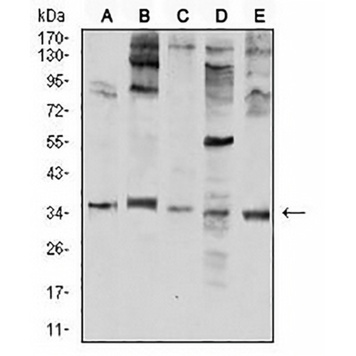Neutrophil Elastase Mouse Monoclonal Antibody(C2683)