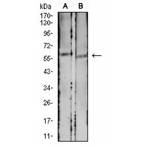 CD39 Mouse Monoclonal Antibody(C2687)
