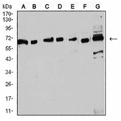 Estrogen Receptor alpha Mouse Monoclonal Antibody(C2693)