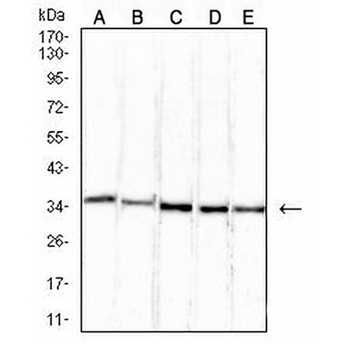 ETFA Mouse Monoclonal Antibody(C2696)