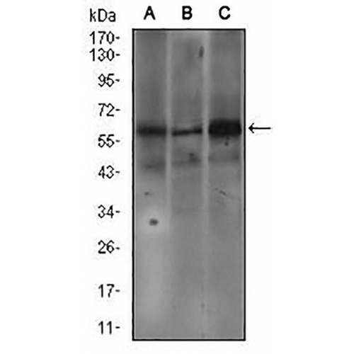 Fc epsilon RI alpha Mouse Monoclonal Antibody(C2701)