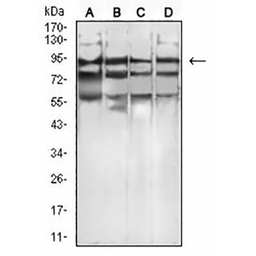 FGFR4 Mouse Monoclonal Antibody(C2702)