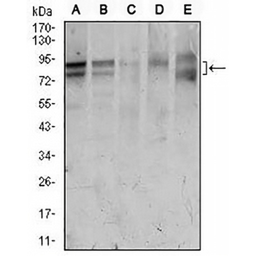 FOXP1 Mouse Monoclonal Antibody(C2705)