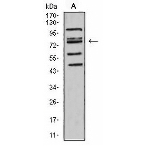 FOXP2 Mouse Monoclonal Antibody(C2706)