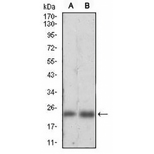 Ferritin L Mouse Monoclonal Antibody(C2708)