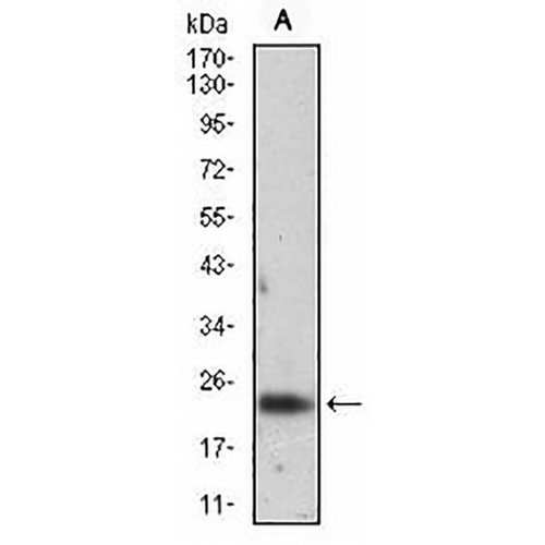 Ferritin L Mouse Monoclonal Antibody(C2709)