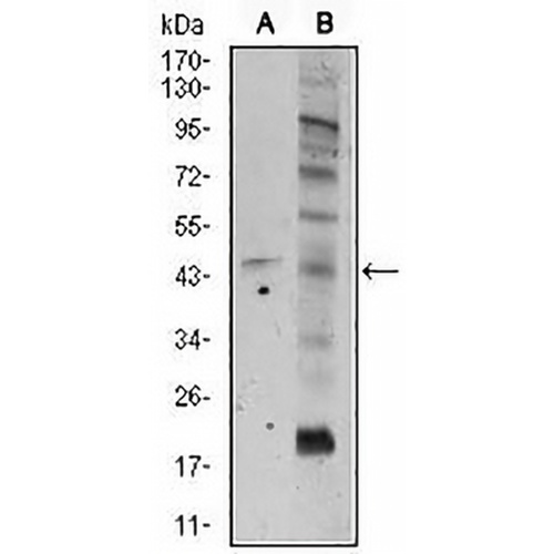 Frizzled 5 Mouse Monoclonal Antibody(C2711)