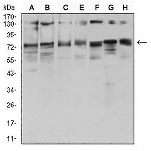 GFAT Mouse Monoclonal Antibody(C2714)