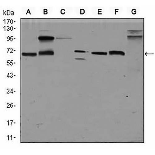 Glypican 3 Mouse Monoclonal Antibody(C2720)