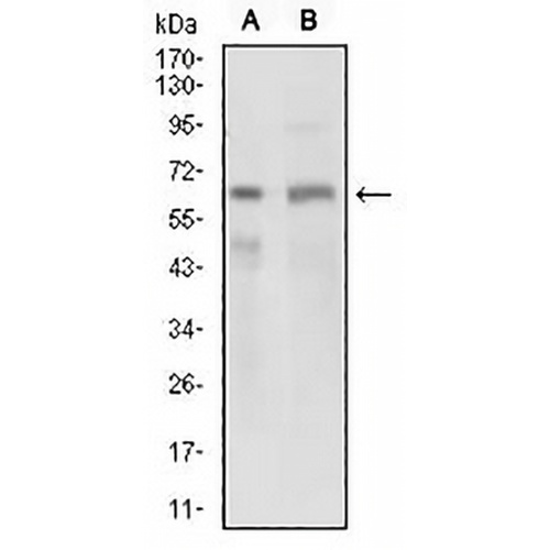 GPNMB Mouse Monoclonal Antibody(C2721)
